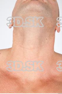 Neck texture of Dale 0001